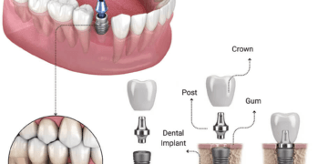 Best Dentist in Lahore