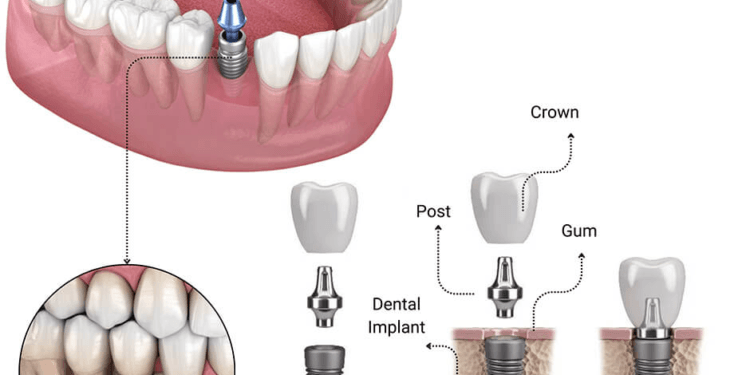 Best Dentist in Lahore