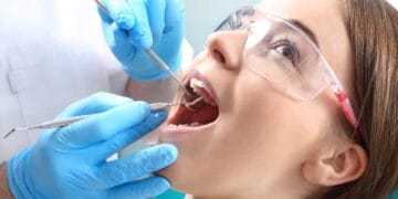 Understanding Root Canal Procedures in Mississauga