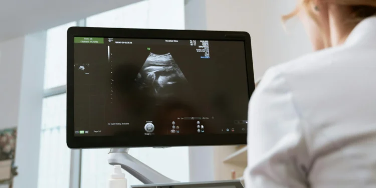 Why Diagnostic Medical Sonographer Schools Are Key to Mastering Cutting-Edge Imaging Tech